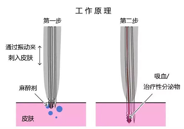 為了生態(tài)，荷蘭人很會有效利用昆蟲資源